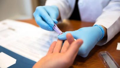 What Are the Symptoms of HIV/AIDS?