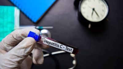 What Are the Symptoms of Hepatitis B and C?