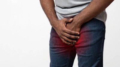 symptoms of chlamydia/ Scrotum Peeling and Itchy