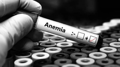 How Iron Deficiency Affects Male and Females Health