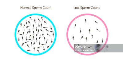 What Are the Causes of Low Sperm Count and Its Treatment?