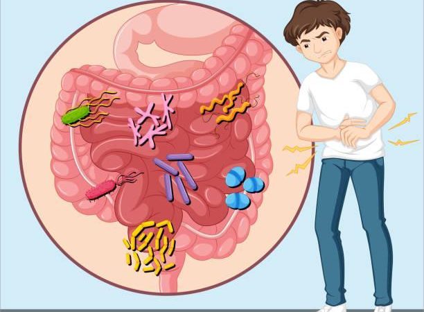 What is Small Intestinal Bacterial Overgrowth (SIBO)