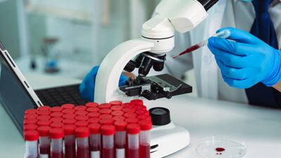 what blood tests mean
