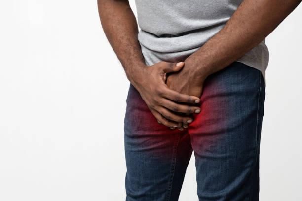 symptoms of chlamydia/ Scrotum Peeling and Itchy