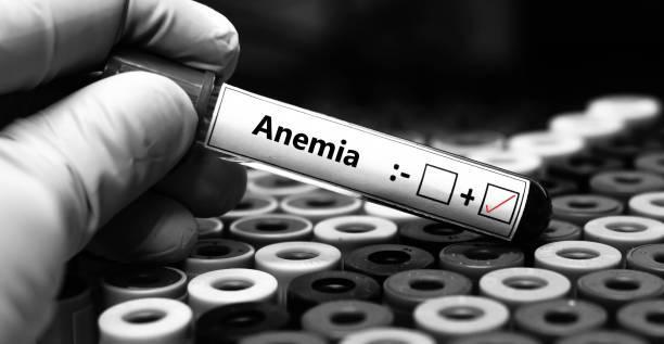 Iron Deficiency Affects