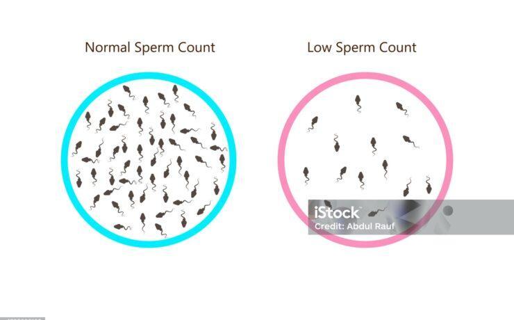 causes of low sperm counts