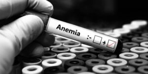 Iron Deficiency Affects