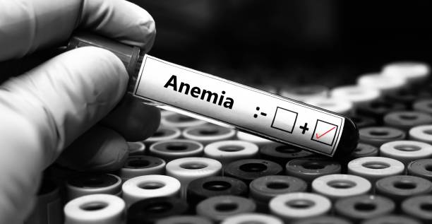 Iron Deficiency Affects