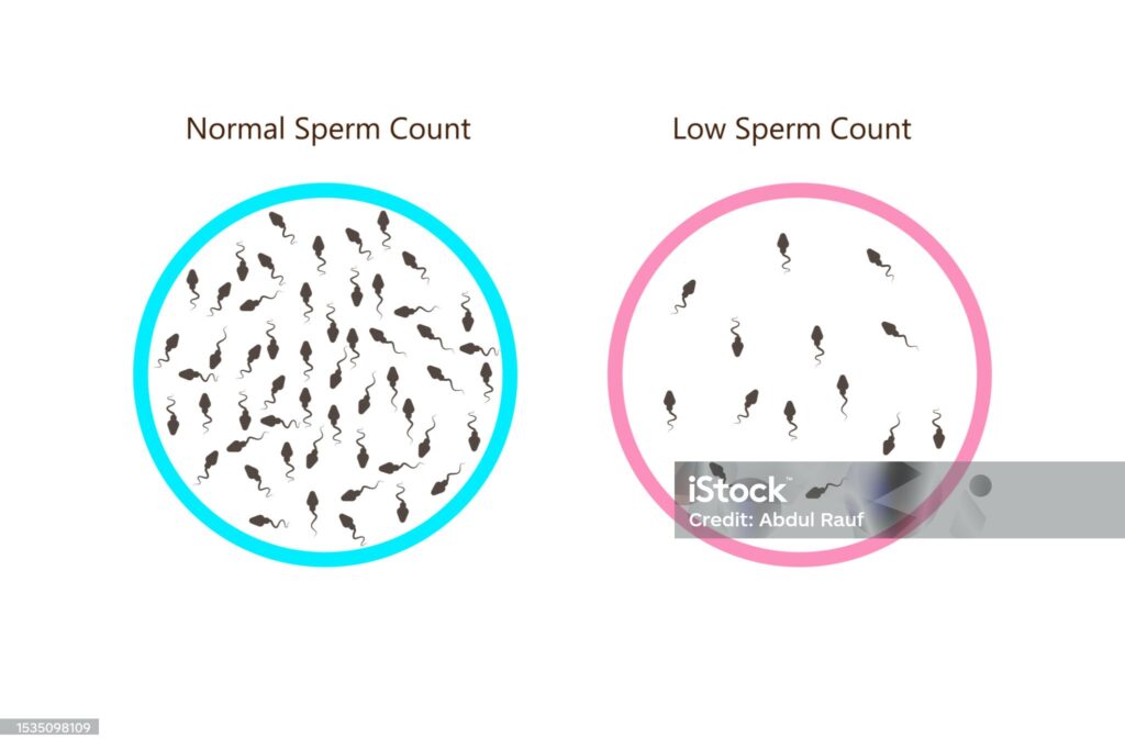 causes of low sperm counts